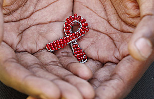 HIV/AIDS Program